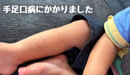 次男が手足口病に！！